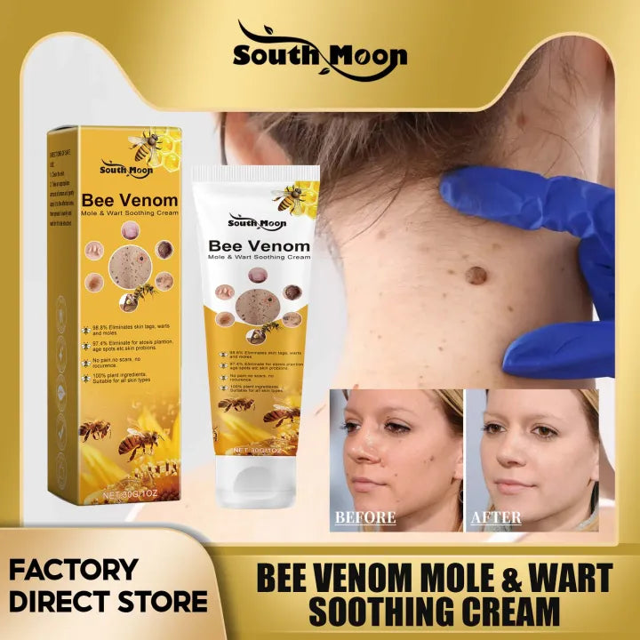 SouthMoon™™ Bee Venom Mole & Wart Soothing Cream ( BUY 1 GET 1 FREE)
