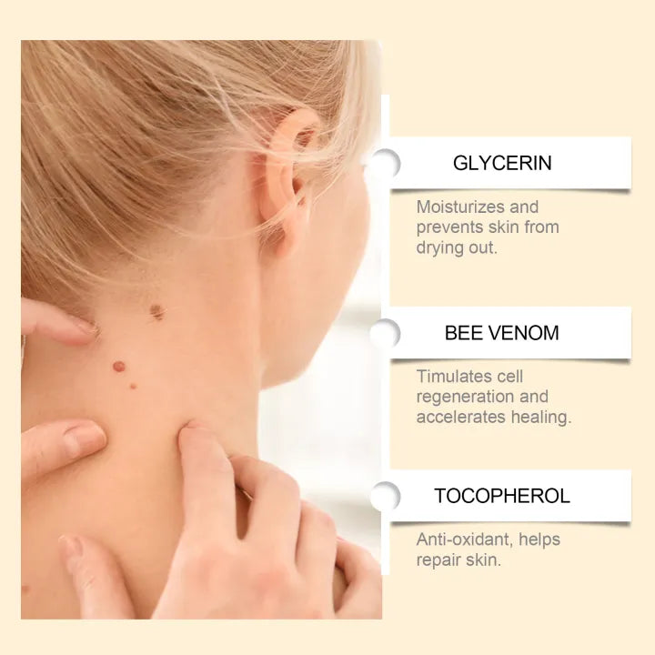 SouthMoon™™ Bee Venom Mole & Wart Soothing Cream ( BUY 1 GET 1 FREE)
