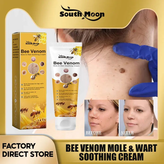 SouthMoon™™ Bee Venom Mole & Wart Soothing Cream ( BUY 1 GET 1 FREE)